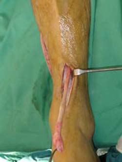 Deformazioni neurologiche 1